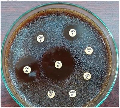 Case Report of <mark class="highlighted">Urethritis</mark> in a Male Patient Infected with Two Different Isolates of Multiple Drug-Resistant Neisseria gonorrhoeae